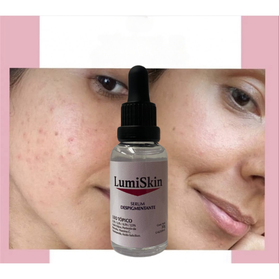 LumiSkin Sérum Despigmentante 30ml