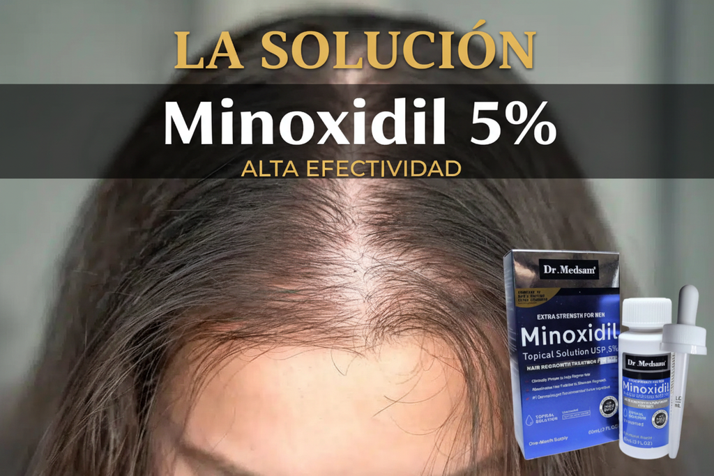 La Solución - Minoxidil 5% Alta Efectividad